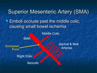Superior Mesenteric Artery (SMA)Superior Mesenteric Artery (SMA)
 Emboli occlude past the middle colic,Emboli occlude past the middle colic,
causing small bowel ischemiacausing small bowel ischemia
SMA
Middle Colic
Right Colic
Ileocolic
Jejunal & Ileal
Arteries
Occlusion
Point
 