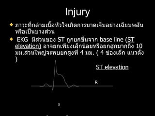 Injury ภาวะที่กล้ามเนื้อหัวใจเกิดการบาดเจ็บอย่างเฉียบพลัน หรือเป็นบางส่วน EKG  มีส่วนของ  ST  ถูกยกขึ้นจาก  base line ( ST   elevation)   อาจยกเพียงเล็กน้อยหรือยกสูกมากถึง  10  มม . ส่วนใหญ่จะพบยกสูงที่  4  มม .  ( 4  ช่องเล็ก แนวตั้ง  ) ST elevation   R   S P  T Q 