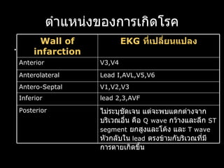 ตำแหน่งของการเกิดโรค . ไม่ระบุชัดเจน แต่จะพบแตกต่างจากบริเวณอื่น คือ  Q   wave  กว้างและลึก  ST segment   ยกสูงและโค้ง และ  T wave   หัวกลับใน   lead   ตรงข้ามกับริเวณที่มีการตายเกิดขึ้น Posterior lead   2,3,AVF Inferior V1,V2,V3 Antero-Septal  Lead I,AVL,V5,V6 Anterolateral V3,V4 Anterior EKG  ที่เปลี่ยนแปลง Wall of infarction 