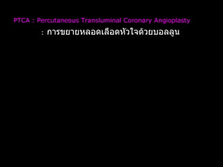 PTCA : Percutaneous   Transluminal Coronary Angioplasty  :   การขยายหลอดเลือดหัวใจด้วยบอลลูน 