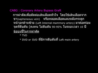 CABG : Coronary Artery Bypass Graft   การผ่าตัดเพื่อตัดต่อเส้นเลือดหัวใจ  โดยใช้เส้นเลือดจากขา (sapheneous vein)   หรือหลอดเลือดแดงหลังกระดูกหน้าอกด้านซ้าย  (Left Internal mammory artery)   มาต่อคร่อมจุดที่ตีบตัน  ( คงทน ไม่ตีบตัน  90-95%   ในระยะเวลา  10   ปี ข้อบ่งชี้ในการผ่าตัด   *   TVD * DVD or   SVD   ที่มีการตีบตันที่  Left main   artery 