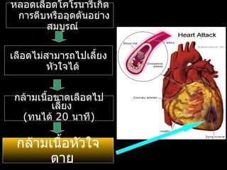 เลือดไม่สามารถไปเลี้ยงหัวใจได้ หลอดเลือดโคโรนารีเกิดการตีบหรืออุดตันอย่างสมบูรณ์  กล้ามเนื้อหัวใจตาย กล้ามเนื้อขาดเลือดไปเลี้ยง  ( ทนได้  20  นาที ) 
