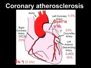 . Coronary atherosclerosis   อันตรายมาก 4.5% 23% (LAD) 45% (RCA) 25% อื่น ๆ   (2.5%)   
