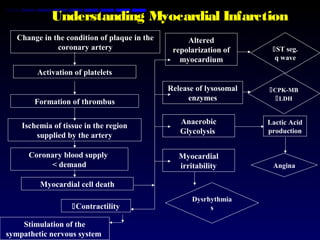 Understanding Myocardial Infarction
Change in the condition of plaque in the
coronary artery
Activation of platelets
Formation of thrombus
Ischemia of tissue in the region
supplied by the artery
Coronary blood supply
< demand
Myocardial cell death
Contractility
Stimulation of the
sympathetic nervous system
Altered
repolarization of
myocardium
Release of lysosomal
enzymes
Anaerobic
Glycolysis
Myocardial
irritability
Dysrhythmia
s
ST seg.
q wave
CPK-MB
LDH
Lactic Acid
production
Angina
 