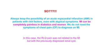 SO???!!! 
Always keep the possibility of an acute myocardial infarction (AMI) in 
patients with risk factors, even with atypical symptoms. MI can be 
completely painless in diabetics and women. We do not need the 
symptoms of chest pain (CP) to diagnose an MI. 
In this case, the RLQ pain was not related to the MI 
but with the previously diagnosed renal cyst. 
 
