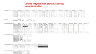 Cardiac enzymes were positive, showing 
troponin elevation 
 