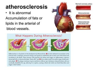 atherosclerosis
• It is abnormal
Accumulation of fats or
lipids in the arterial of
blood vessels.
 