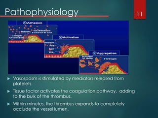 Pathophysiology
 Vasospasm is stimulated by mediators released from
platelets.
 Tissue factor activates the coagulation pathway, adding
to the bulk of the thrombus.
 Within minutes, the thrombus expands to completely
occlude the vessel lumen.
11
 