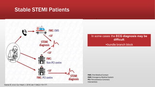 In some cases the ECG diagnosis may be
difficult:
bundle branch block
Stable STEMI Patients
Ibanez B, et al. Eur Heart J. 2018 Jan 7;39(2):119-177.
,
FMC: first Medical Contact
EMS: Emergency Medical System
PCI: Percutaneous Coronary
Intervention
 