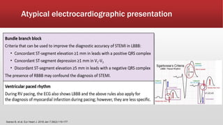 Atypical electrocardiographic presentation
Ibanez B, et al. Eur Heart J. 2018 Jan 7;39(2):119-177.
 