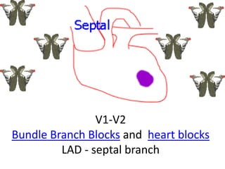 V1-V2
Bundle Branch Blocks and heart blocks
LAD - septal branch
 