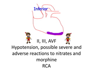 II, III, AVF
Hypotension, possible severe and
adverse reactions to nitrates and
morphine
RCA
 