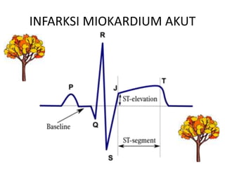 INFARKSI MIOKARDIUM AKUT
 