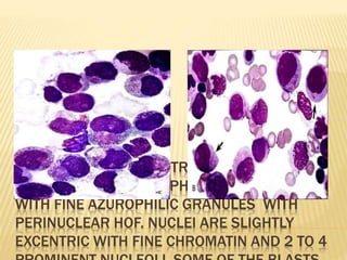 BMA SMEARS DEMONSTRATE LARGE BLASTS
WITH ABUNDANT BASOPHILIC CYTOPLASM
WITH FINE AZUROPHILIC GRANULES WITH
PERINUCLEAR HOF. NUCLEI ARE SLIGHTLY
EXCENTRIC WITH FINE CHROMATIN AND 2 TO 4
 