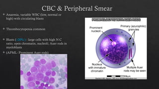 Acute Myeloid Leukaemia (AML)_Dr Dibyajyoti Prusty, MD.pptx