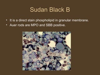 Sudan Black B 
• It is a direct stain phospholipid in granular membrane. 
• Auer rods are MPO and SBB positive. 
 