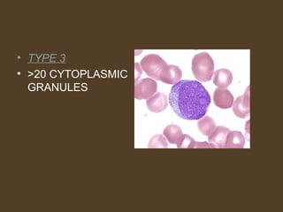 • TYPE 3 
• >20 CYTOPLASMIC 
GRANULES 
 