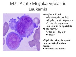 Acute myeloid leukemia | PDF