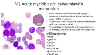 M2 Acute myeloblastic leukaemiawith
maturation
• Small to medium-sized blasts with high (n:c)
• ratio and rounded nuclei sometimes located in a
corner of the cytoplasm.
• The nucleus shows dispersed, immature chromatin
with one or more nucleoli.
• The cytoplasm is basophilic and can containtraces
of primary azurophilic granulation or isolated Auer
rods.
Immunophenotype
•MPO +
•CD34 +/-
•CD13 +
•CD15 +
•HLA-DR +/-
•Sudan black +
 