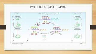 ACUTE MYELOID LEUKEMIA PPT .presentstion | PPTX