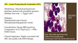 ACUTE MYELOID LEUKEMIA. .pptx