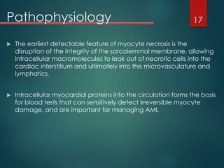 Acute Myocardial Infarction | PPTX