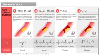 Acute Myocardial Infarction and its diagnosis .pptx