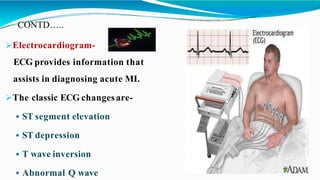 CONTD…..
Electrocardiogram-
ECG provides information that
assists in diagnosing acute MI.
The classic ECG changesare-
 ST segment elevation
 ST depression
 T wave inversion
 Abnormal Q wave
 