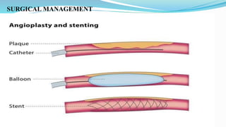 SURGICAL MANAGEMENT
 