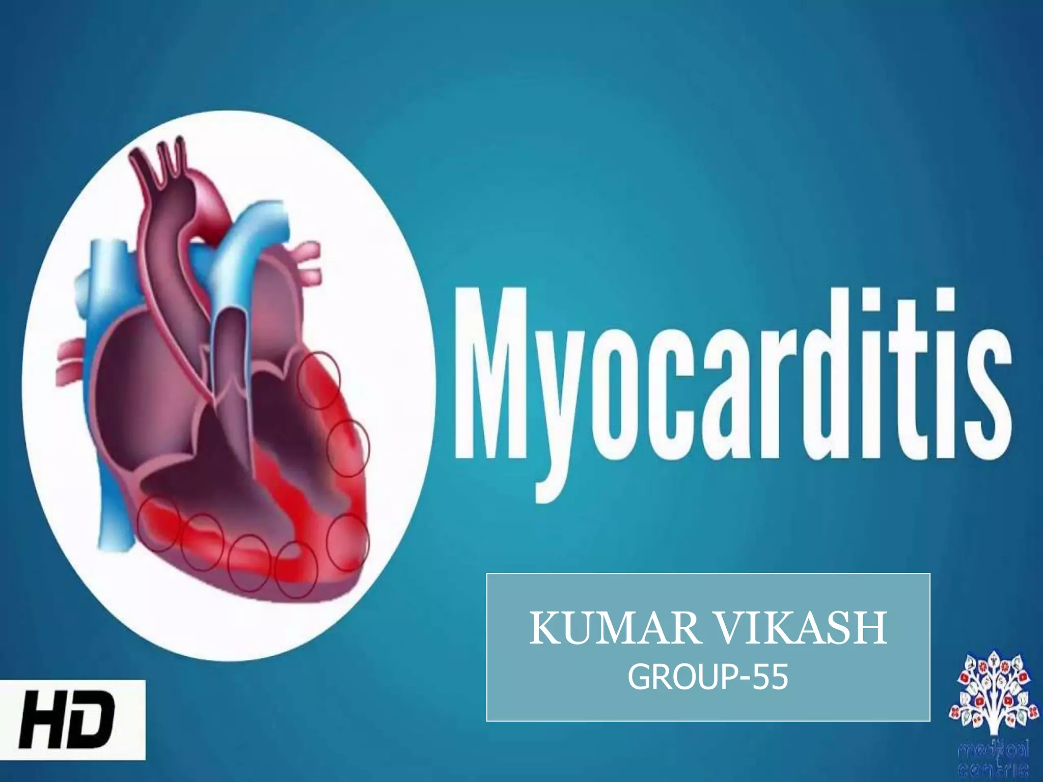 Myocardiris Acute myocarditis - Dr.vikash kumar, BSMU | PPT | Heart and ...