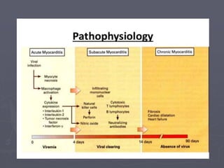 Acute myocarditis - Dr.vikash kumar, BSMU | PPT