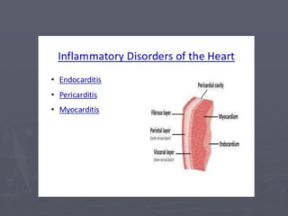 Acute myocarditis - Dr.vikash kumar, BSMU | PPT