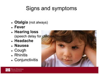  Otalgia (not always)
 Fever
 Hearing loss
(speech delay for children)
 Headache
 Nausea
 Cough
 Rhinitis
 Conjunctivitis
Signs and symptoms
 