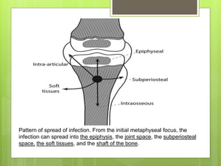 Pattern of spread of infection. From the initial metaphyseal focus, the
infection can spread into the epiphysis, the joint space, the subperiosteal
space, the soft tissues, and the shaft of the bone.
 