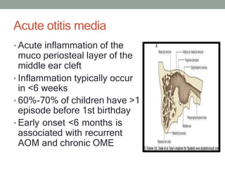 Acute otitis media
• Acute inflammation of the
muco periosteal layer of the
middle ear cleft
• Inflammation typically occu...