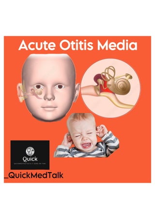 Acute otitis media .pdf ENT BY QUICKMEDTALK