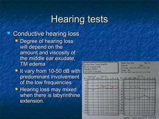 Hearing testsHearing tests
 Conductive hearing lossConductive hearing loss
 Degree of hearing lossDegree of hearing loss
will depend on thewill depend on the
amount and viscosity ofamount and viscosity of
the middle ear exudate,the middle ear exudate,
TM edemaTM edema
 It vary from 10-50 dB withIt vary from 10-50 dB with
predominant involvementpredominant involvement
of the low frequenciesof the low frequencies
 Hearing loss may mixedHearing loss may mixed
when there is labyrinthinewhen there is labyrinthine
extension.extension.
 