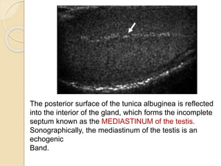The posterior surface of the tunica albuginea is reflected
into the interior of the gland, which forms the incomplete
septum known as the MEDIASTINUM of the testis.
Sonographically, the mediastinum of the testis is an
echogenic
Band.
 