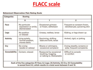 FLACC scale
 