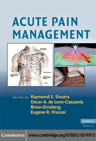 Acute pain management | PDF