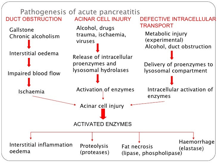 Acute Pancreatitis