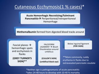 Cutaneous Ecchymosis(1 % cases)*
Acute Hemorrhagic Necrotizing/fulminant
Pancreatitis Periperitoneal/retroperitoneal
Hemorrhage
Methemalbumin formed from digested blood tracks around
Fascial planes 
hemorrhagic spots
and ecchymosis in
flanks
(GREY TURNER’S
SIGN)**
FALCIFORM
LIGAMENT  Bluish
Discoloration around
umbilicus
(CULLEN’S SIGN)
(umbllical black eye)
Below inguinal ligament
(FOX SIGN)
*Neither sign is pathognomonic of acute pancreatitis
*takes 24-48 hours to develop with 10-40 % mortality
**More commonly, ruddy
erythema in flanks due to
extravasated pancreatic exudate
 