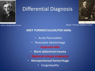Differential Diagnosis
GREY TURNER/CULLEN/FOX SIGNs
• Acute Pancreatitis
• Pancreatic Hemorrhage
• Ruptured AAA
• Blunt abdominal trauma
• Ruptured ectopic pregnancy
• Retroperitoneal hemorrhage
• Coagulopathy
Above: George Grey Turner Above: Thomas Stephen Cullen
 