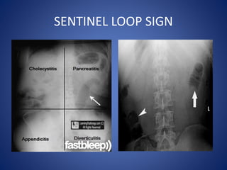 SENTINEL LOOP SIGN
 