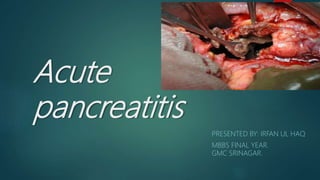 Acute
pancreatitis
PRESENTED BY: IRFAN UL HAQ
MBBS FINAL YEAR.
GMC SRINAGAR.
 