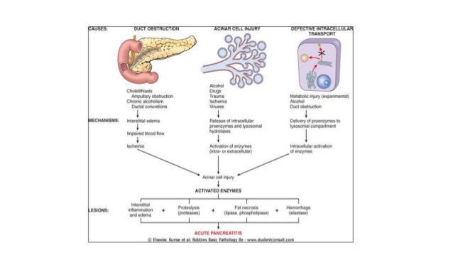 Acute pancreatitis anatomy pathogenesis and management