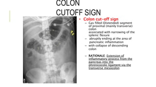 COLON
CUTOFF SIGN
• Colon cut-off sign
– Gas filled (Distended) segment
of proximal (mainly transverse)
colon
associated with narrowing of the
splenic flexure
– abruptly ending at the area of
pancreatic inflammation
– with collapse of descending
colon
– RATIONALE: Extension of
inflammatory process from the
pancreas into the
phrenicocolic ligament via the
transverse mesocolon
 