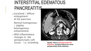 INTERSTITIAL EDEMATOUS
PANCREATITIS
 Localized / diffuse
enlargement
of the pancreas
Normal homogenous
/ slightly
heterogenous
enhancement
 Mild inflammatory
changes in the
peripancreatic soft
tissue : i.e: stranding 63yold. There is peripancreatic fat
stranding (arrows) without an acute
peripancreatic fluid collection.
 