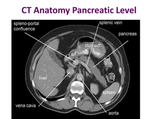 CT Anatomy Pancreatic Level
 