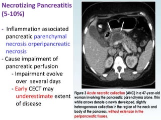 - Inflammation associated
pancreatic parenchymal
necrosis orperipancreatic
necrosis
- Cause impairment of
pancreatic perfusion
- Impairment evolve
over several days
- Early CECT may
underestimate extent
of disease
Necrotizing Pancreatitis
(5-10%)
 